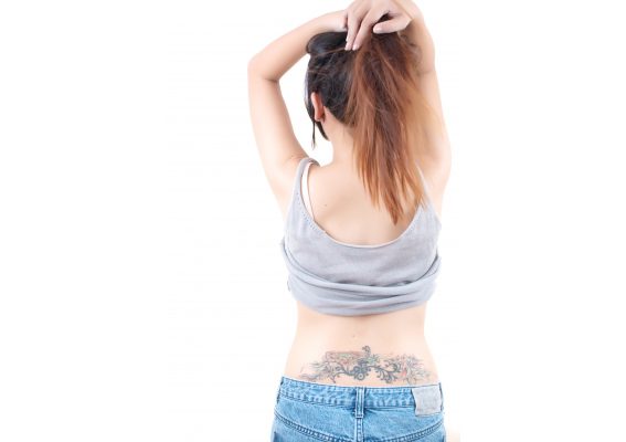 Ein Praxisbericht zur Entfernung von Tattoos